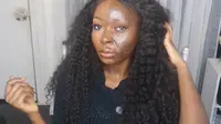 Shalom Nchom gadis dengan tubuh terbakar bisa tampil cantik dengan teknik makeup