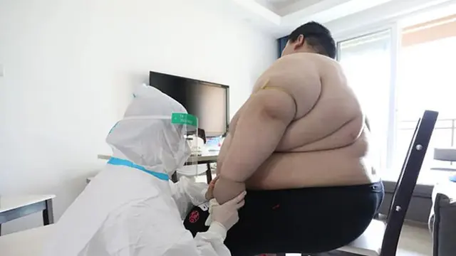 obesitas