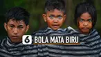 Bukan menggunakan softlens tapi bola mata mereka asli berwarna biru.