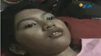 Dokter kejiwaan yang sempat memeriksa Echa menyatakan, gadis ini menderita penyakit hypersomnia atau kelebihan tidur.