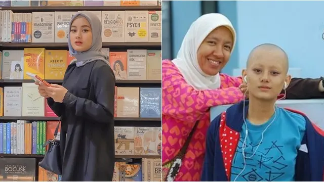 Demi Peran, 5 Artis Cantik Ini Rela Tampil Botak