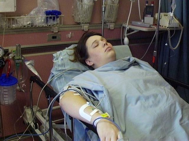 14 Tahun Mengeluh Sakit Punggung Ternyata Jarum Epidural