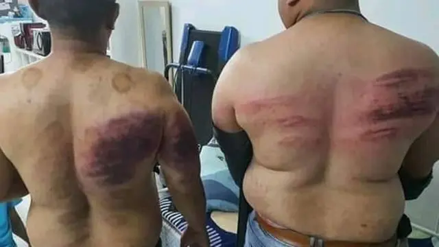 Ketahuan Puasa, Dua Karyawan Ini Alami Kekerasan oleh Majikannya