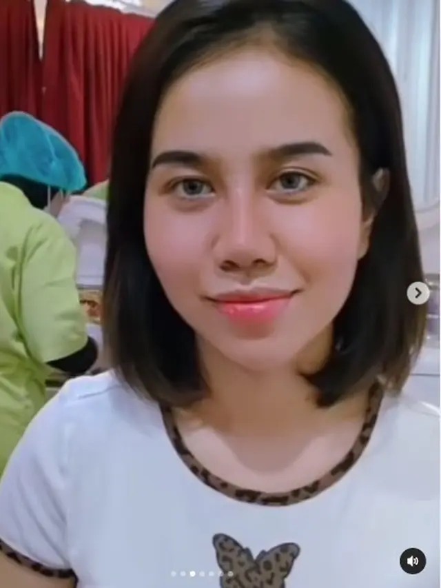 8 Potret Perubahan Wajah Mayang Usai Operasi Hidung, Sudah Lepas Perban