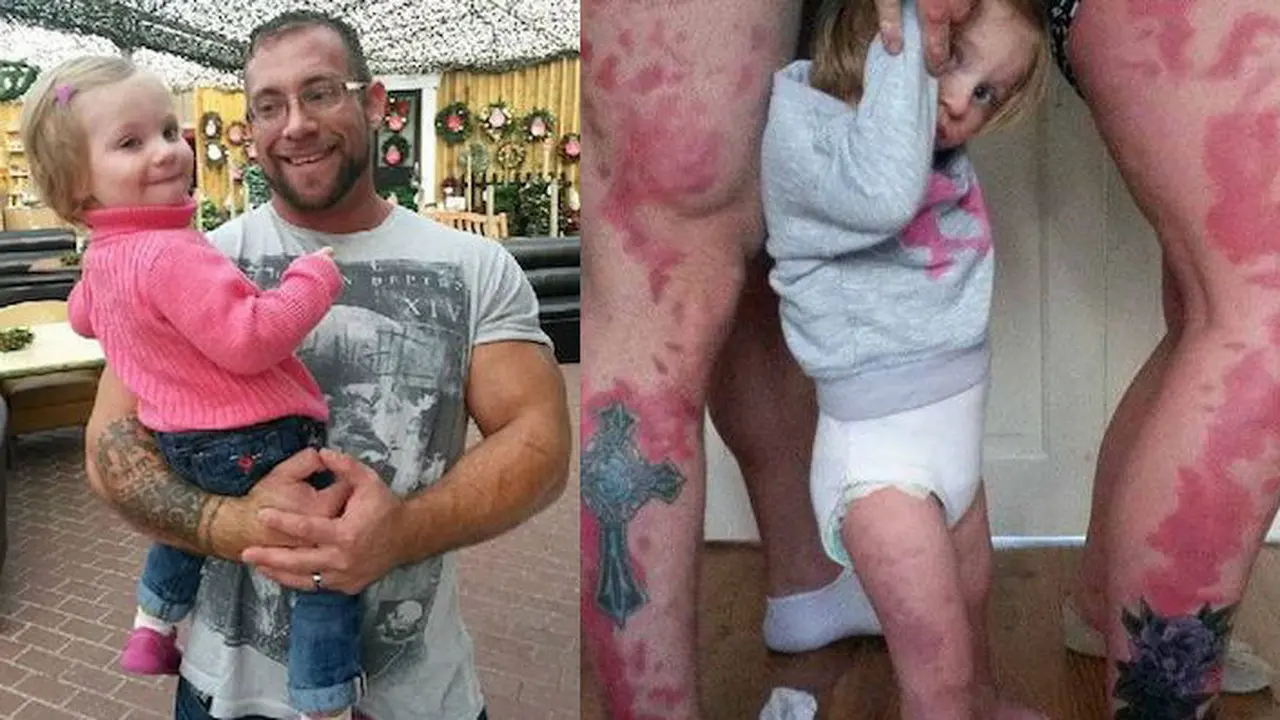 Sepasang Orangtua Men-Tattoo Kaki Sesuai Tanda Lahir Anaknya