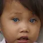 Amelia Anggraeni, bocah 2,5 tahun prmilik bola mata yang bisa berubah warna putih, coklat, abu-abu dan biru. (Liputan6.com/Huyogo Simbolon)