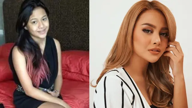 Penampilan Berbeda Drastis, 5 Seleb ini Dituding Operasi Plastik