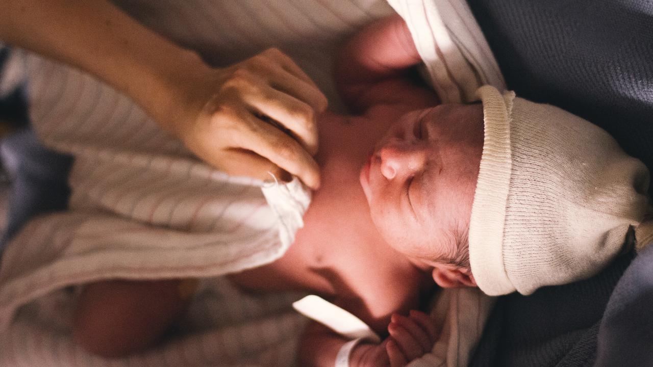 Ilustrasi Risiko Gangguan Pendengaran pada Bayi Kuning