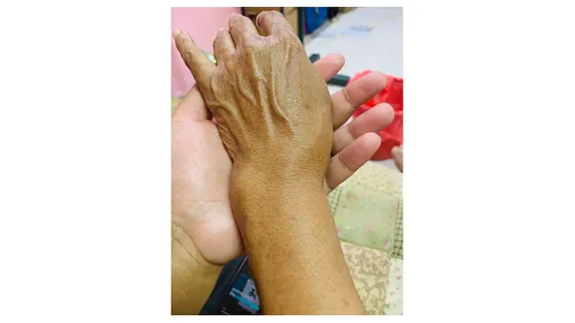 Meski Alami Cedera, Kisah Ibu Masak Saat Hari Raya Ini Bikin Haru