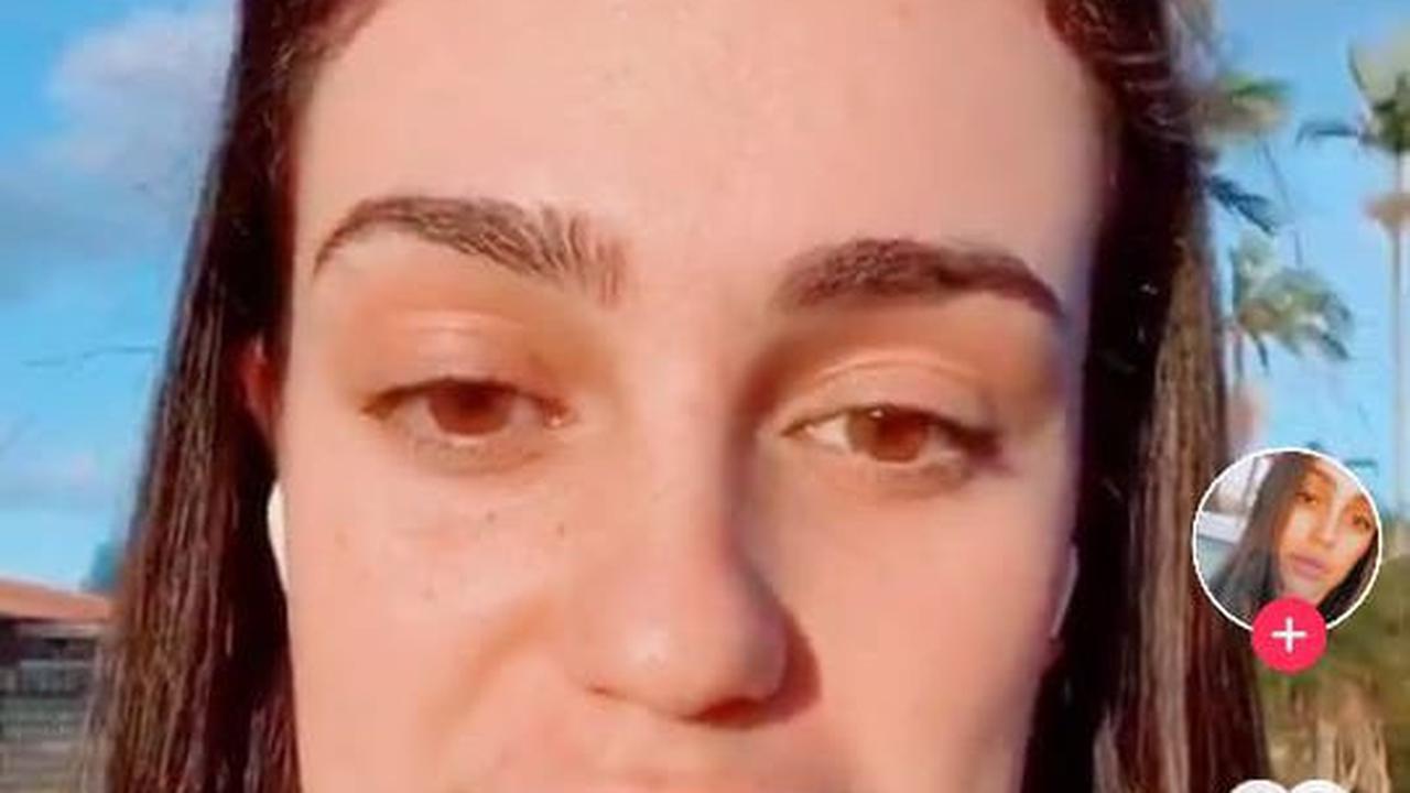 Wajah Perempuan Australia Berubah Jadi Kotak Usai Jalani Perawatan Pengencangan Dagu