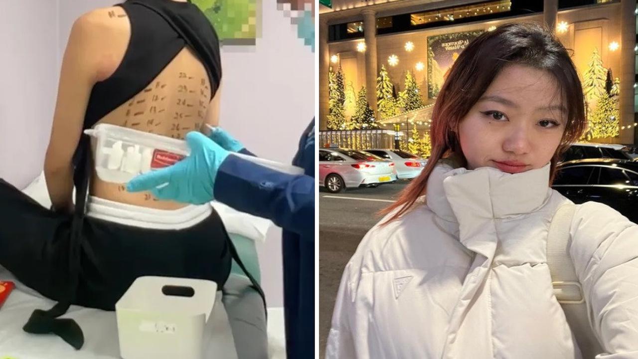 Kisah Wanita dengan 37 Alergi