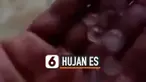 hujan es thumbnail