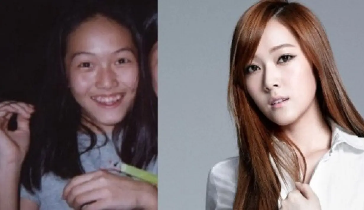 Saat masih remaja, Jessica punya wajah yang biasa. Akan tetapi seiring bertambahnya umur dan bantuan operasi plastik, ia berrubah jadi wanita yang cantik. (Foto: soompi.com)
