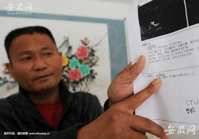 Liu menunjukkan surat terkait operasi yang ia jalani | Photo: Copyright shanghaiist.com