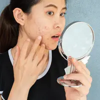 Ilustrasi perempuan dengan kulit wajah yang bermasalah. (depositphotos.com/Boysloso)