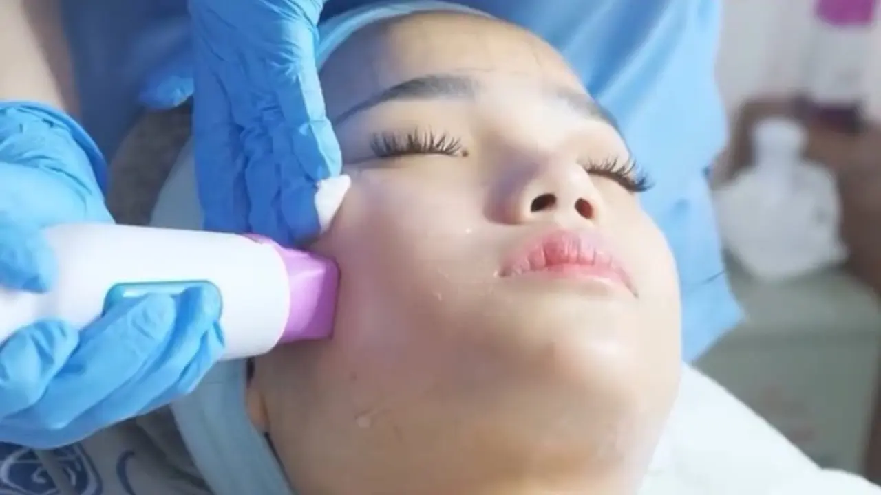Thermage FLX, Teknologi Canggih untuk Kulit Awet Muda Tanpa Operasi