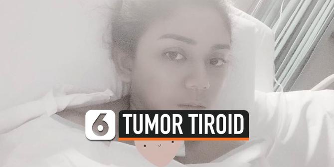 VIDEO: Thalita Latief Idap Penyakit Tumor Tiroid
