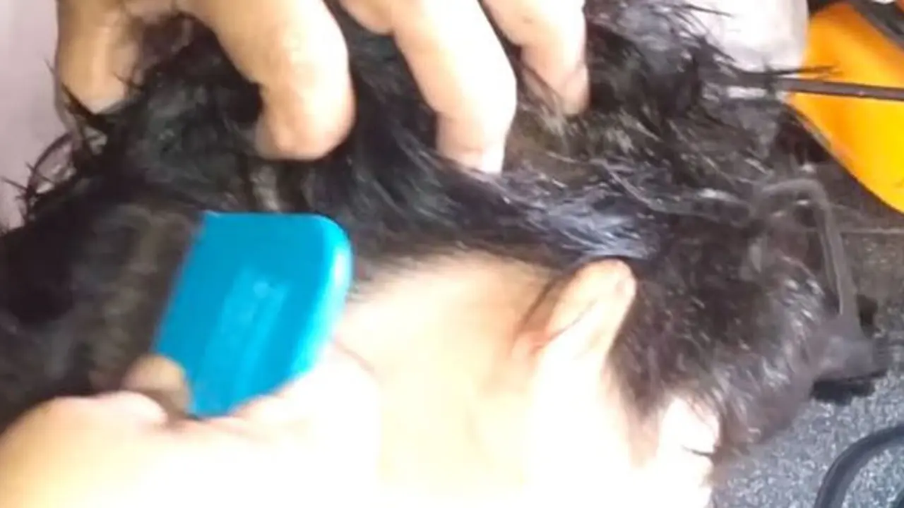 Video Gadis Dengan Ratusan Kutu Ramai di YouTube