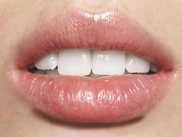 7 Tanda Penyakit Yang Bisa Terlihat Dari Bibir Health Liputan6 Com