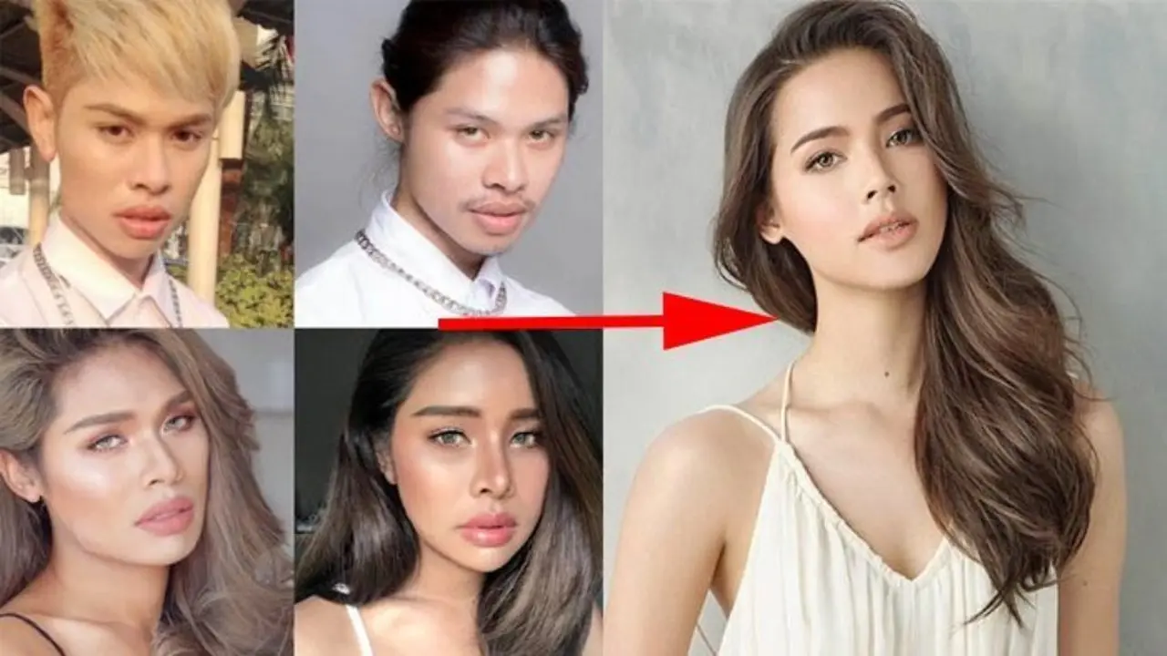 [Bintang] Demi Mirip Idola, Pria Ini Operasi Plastik dan Kelamin, Hasilnya Bikin Bengong