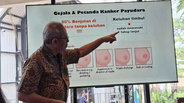 Kanker Payudara Bisa Dicegah, Mulai dari Olahraga dan Hindari Asap Rokok