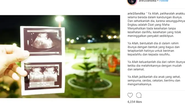Foto hasil USG Ardina Rasti (Instagram@ arie10andika)