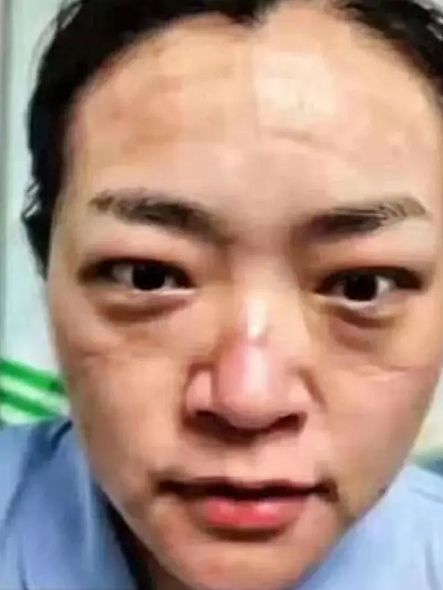 6 Potret Wajah Suster Rawat Pasien Virus Corona Ini Bikin Haru