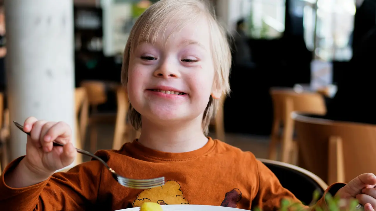 Anak Down Syndrome