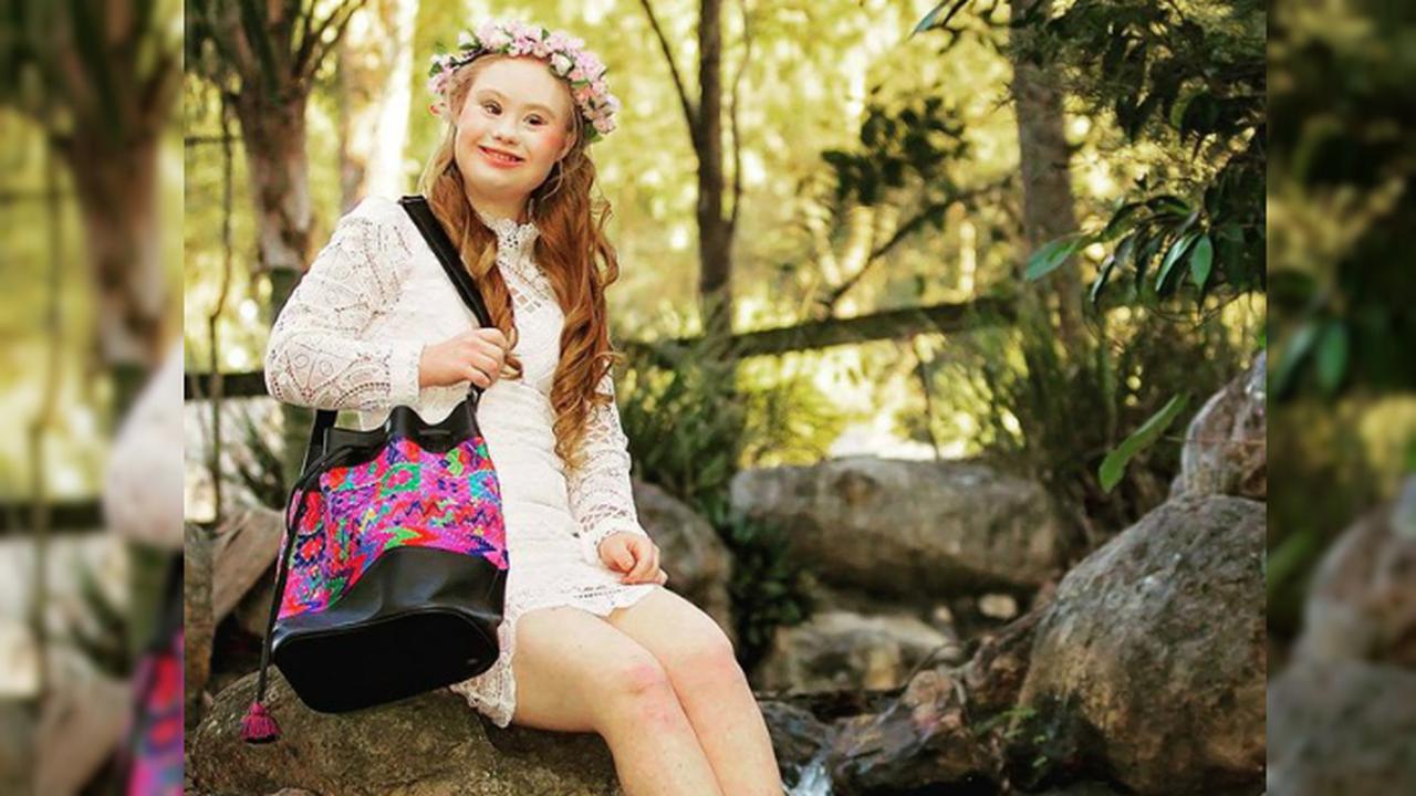 Kisah 9 Anak Down Syndrome yang Berprestasi==OTW