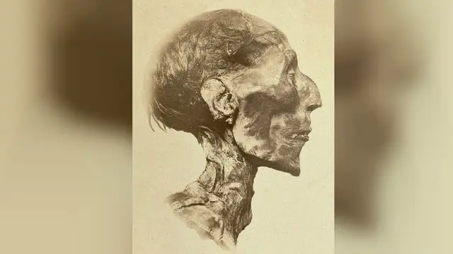 Ilustrasi bentuk hidung orang Romawi (Wikipedia/Public Domain)