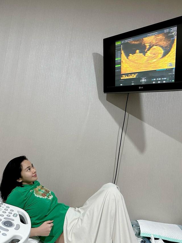 7 Potret Denise Chariesta Saat Periksa Kehamilan, Banjir Kritikan Netizen