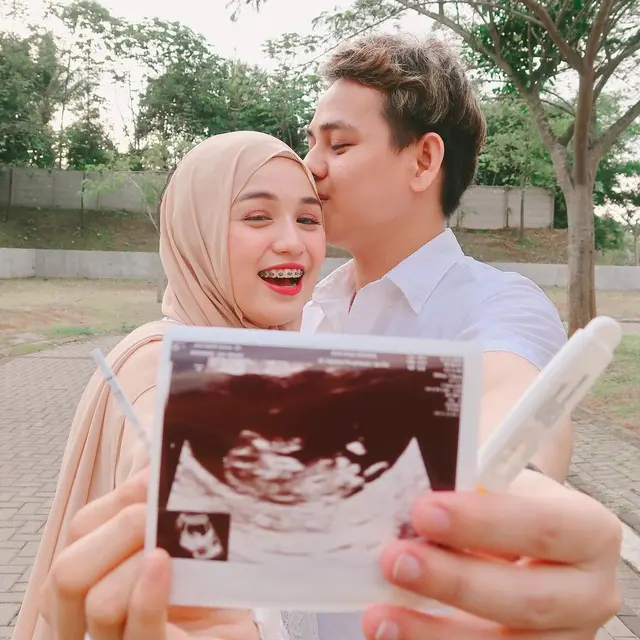 Hamil Anak Pertama, Ini 6 Potret Manis Asri Kasura Ipar Dinda Hauw dan Suami
