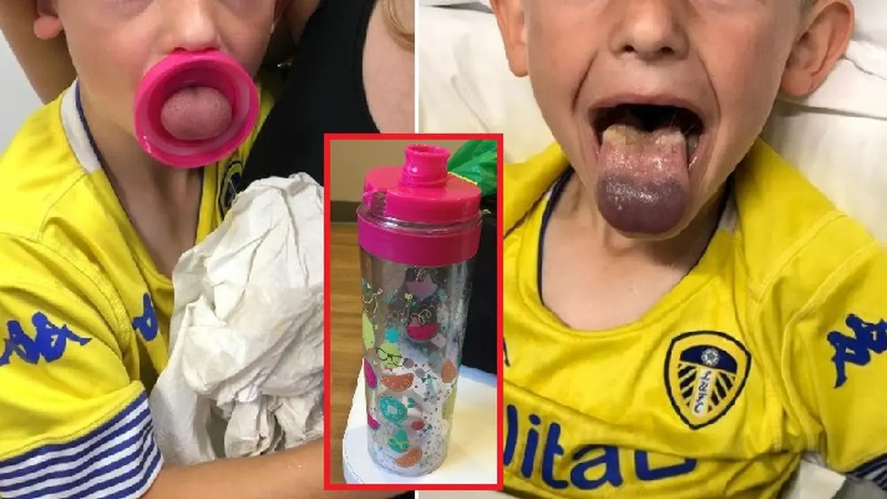 lidah bocah terjepit tutup botol