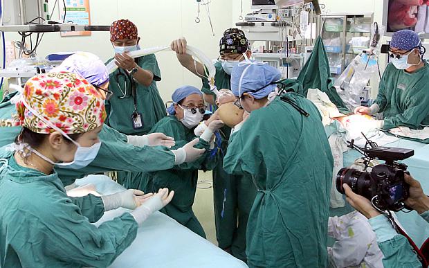 Suasana di ruang operasi saat operasi bedah pemisahan dilakukan | Photo: Copyright telegraph.co.uk