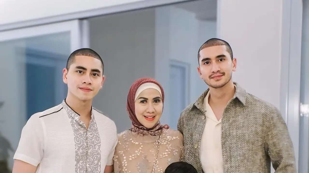 Verrell Bramasta Tampil Botak Usai Transplantasi Rambut, Curi Perhatian