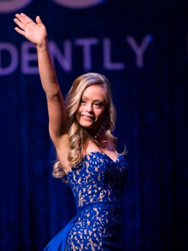 [Bintang] Down Syndrome