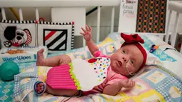 Charlotte Brewer, Athena yang berusia dua bulan mengenakan kostum cupcake saat menjalani perawatan di NICU sebuah rumah sakit di Texas, Rabu (30/10/2019). Pihak RS memakaikan kostum pada bayi-bayi prematur untuk merayakan Halloween pertama mereka. (Sarah A. Miller/Tyler Morning Telegraph via AP)