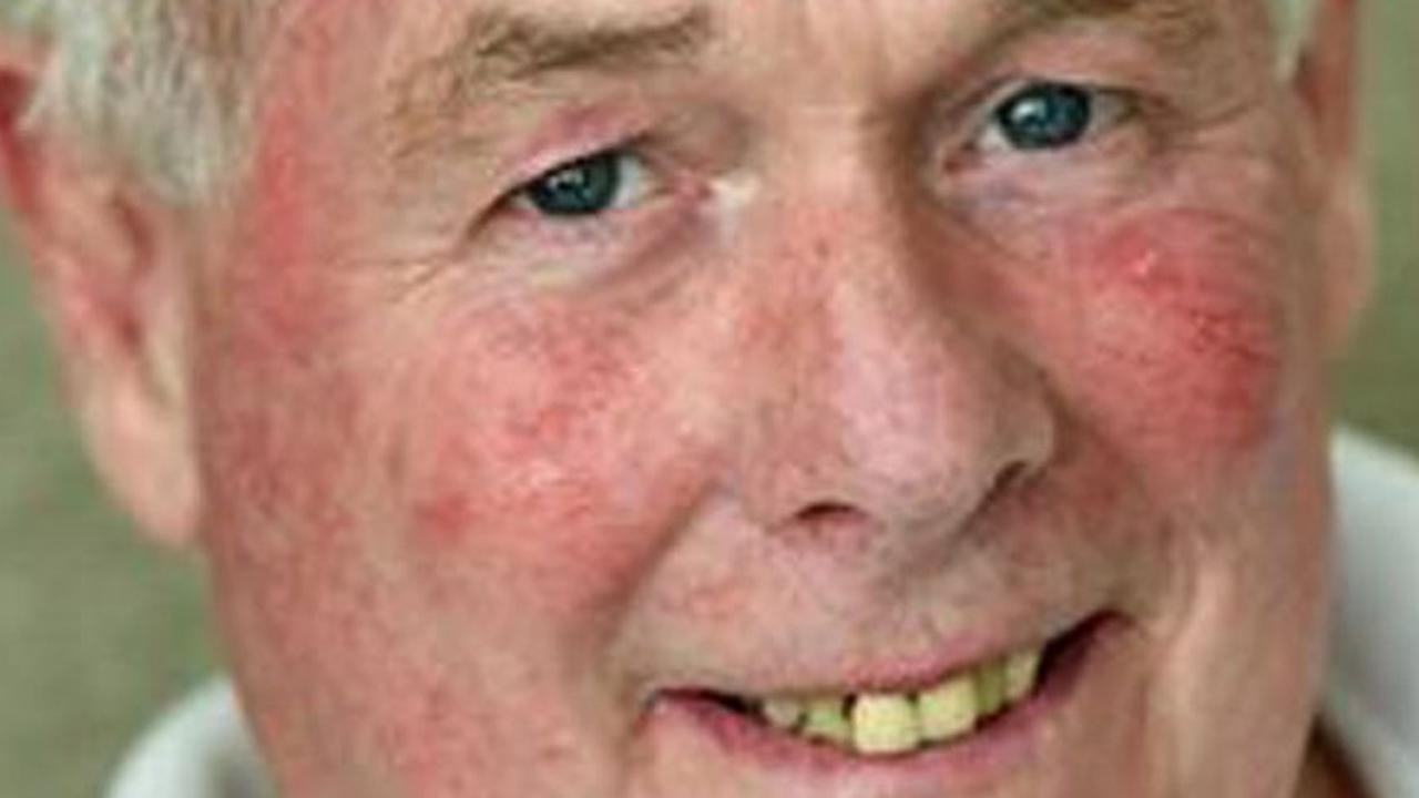 Peter Simpson, mantan polisi, jalani operasi tumor