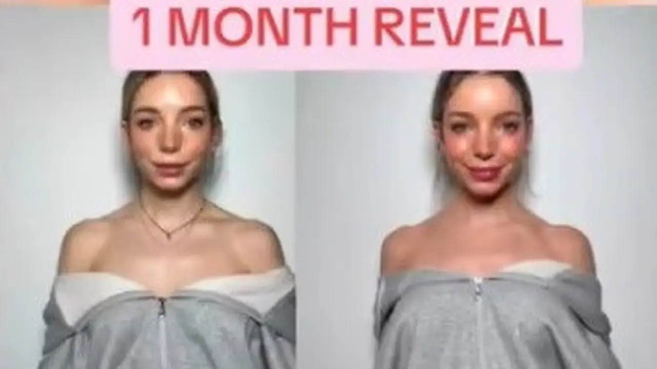 Barbie Botox, Tren Kecantikan Viral Agar Leher Jenjang dan Ramping
