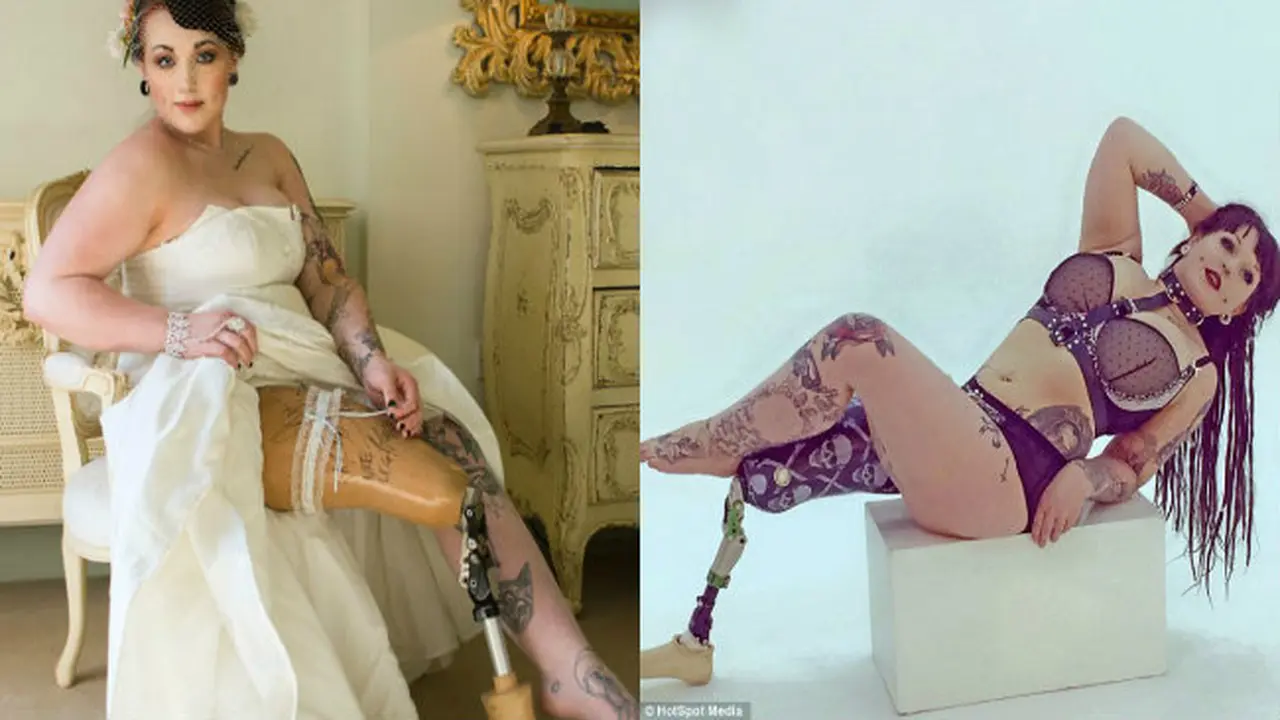 Kaki Diamputasi, Wanita Ini Justru Sukses Jadi Model
