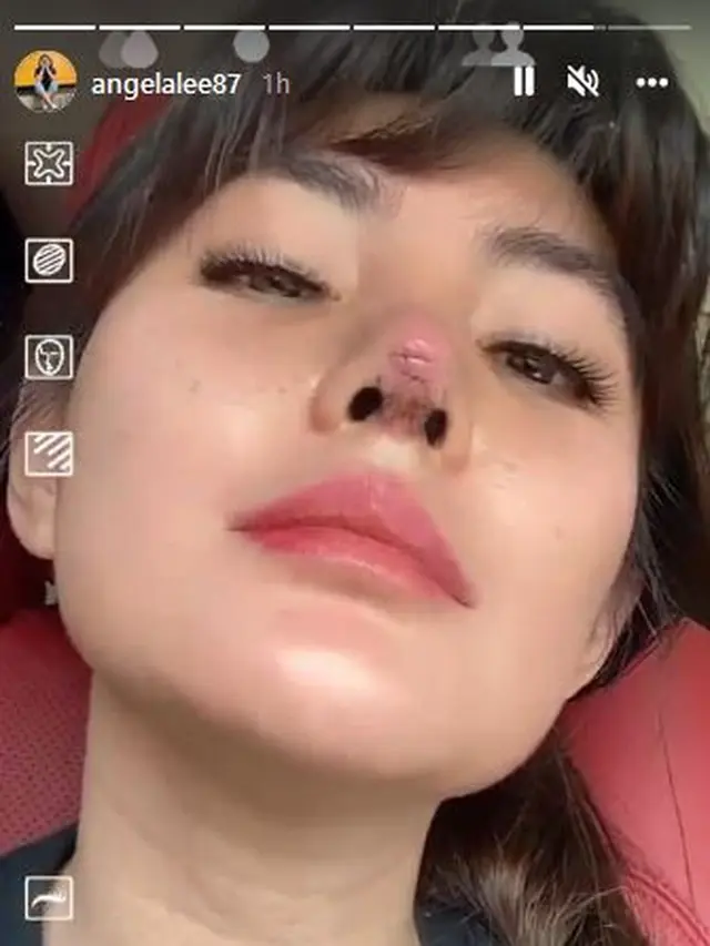 Akui Menyesal, Ini 6 Potret Terbaru Angela Lee Usai Operasi Plastik