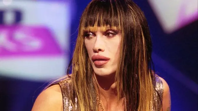 [Bintang] Pete Burns