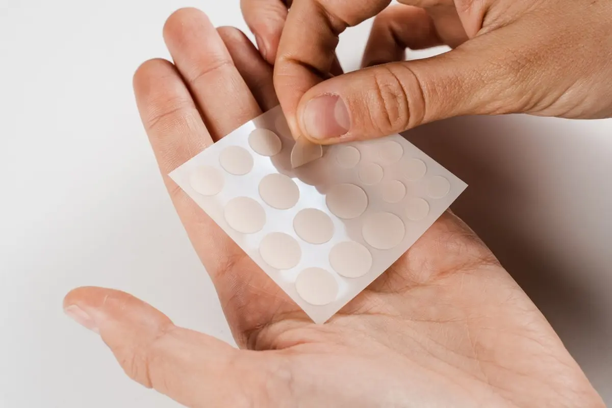 Ilustrasi Acne Patch