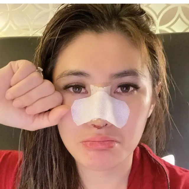 Akui Menyesal, Ini 6 Potret Terbaru Angela Lee Usai Operasi Plastik