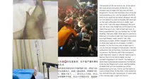 Salah satu korban yang terjepit diantara kerumunan pesta halloween di Itaewon membagikan kisah dan kesaksiannya atas tragedi maut tersebut pada Minggu, (30/10/22) (Liputan6.com/Qorry Layla Aprianti)