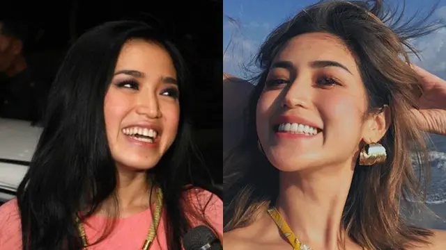 6 Transformasi Seleb Setelah Perbaikan Gigi, Terbaru Elly Sugigi
