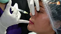 Pasien disuntikkan gel restylane dengan teknik menyuntik dari atas ke bawah. (Liputan6.com/Panji Diksana/wwn)
