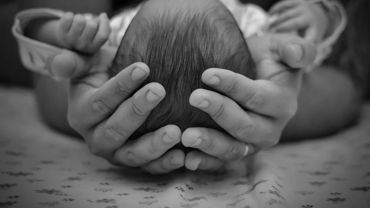 Ilustrasi sindrom apert. Foto: Pexels.