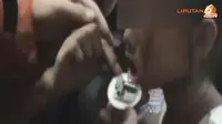 [VIDEO] Rumitnya Evakuasi Bibir Bocah China yang Terjepit Besi