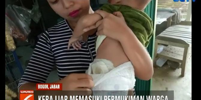 Bocah di Kabupaten Bogor Digigit Kera Liar